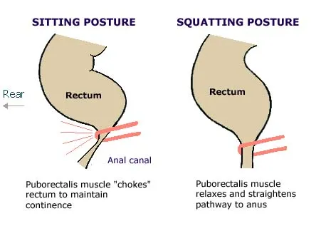 Diagram comparing sitting posture and squatting posture during a bowel movement: sitting causes the puborectalis muscle to 'choke' the rectum to maintain continence, while squatting relaxes the puborectalis muscle and straightens the pathway to the anus.